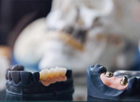 Restorative Dental Materials (SHOFU)